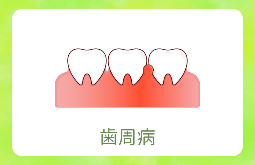 歯周病